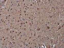 Proteasome beta 1 Antibody, Novus Biologicals 100 &mu;g | Buy Online | Novus Biologicals | Fisher Scientific