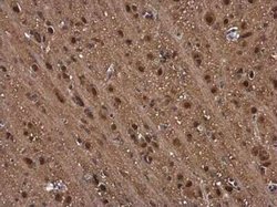 Proteasome beta 1 Antibody, Novus Biologicals 100 &mu;g | Buy Online | Novus Biologicals | Fisher Scientific
