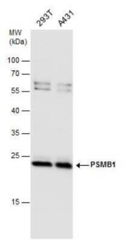 Proteasome beta 1 Antibody, Novus Biologicals 100 &mu;g | Buy Online | Novus Biologicals | Fisher Scientific