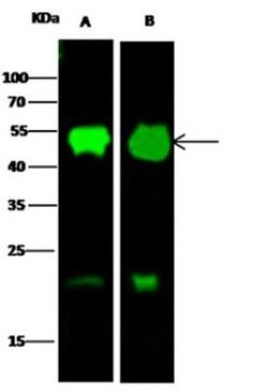 Protein Disulfide Isomerase/P4HB Rabbit anti-Human, Clone: 16, Novus Biologicals