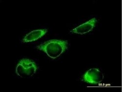 Protein Disulfide Isomerase/P4HB Antibody, Novus Biologicals 0.05 mg, Unconjugated:Antikörper