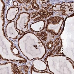 Protein O-Glucosyltransferase 1/POGLUT1/KTELC1 Antibody, Novus Biologicals:Antibodies:Primary