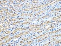 Protein Phosphatase 1 beta Rabbit anti-Human, Mouse, Rat, Clone: 5O9E7,