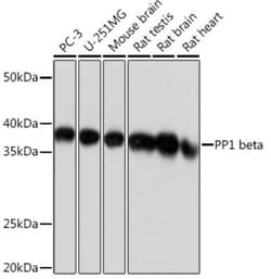 Protein Phosphatase 1 beta Rabbit anti-Human, Mouse, Rat, Clone: 5O9E7,