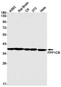 Protein Phosphatase 1 beta Rabbit anti-Human, Mouse, Rat, Clone: S09-6B7,