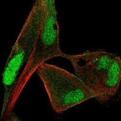 Protein Phosphatase 1 beta Antibody, Novus Biologicals:Antibodies:Primary