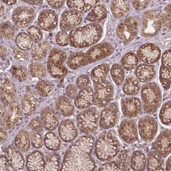Protein Phosphatase 1 beta Antibody, Novus Biologicals:Antibodies:Primary
