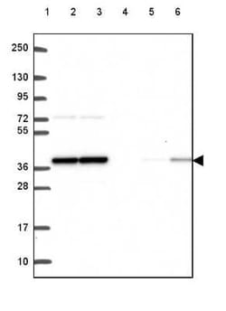 Protein Phosphatase 1 beta Antibody, Novus Biologicals:Antibodies:Primary