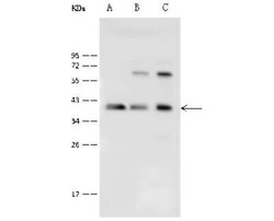 Protein Phosphatase 1C gamma Antibody, Novus Biologicals 100 &mu;g; Unconjugated:Antibodies,