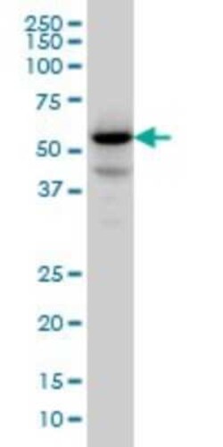Protein phosphatase 1F Antibody (2A9), Novus Biologicals 0.1 mg | Buy Online | Novus Biologicals | Fisher Scientific