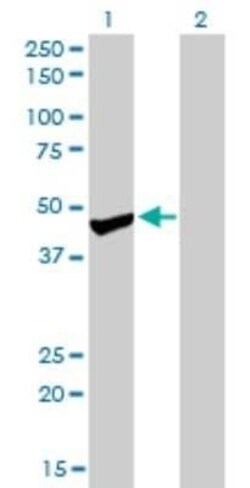 Protein phosphatase 1F Antibody (2A9), Novus Biologicals 0.1 mg | Buy Online | Novus Biologicals | Fisher Scientific