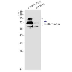 Prothrombin Antibody (S08-5G1), Novus Biologicals 100 &mu;g; Unconjugated:Antibodies,