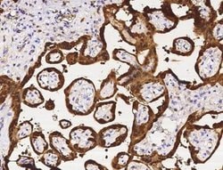 Purine Nucleoside Phosphorylase/PNP Rabbit anti-Human, Clone: 1, Novus