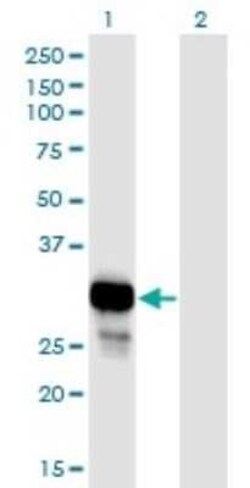 Purine Nucleoside Phosphorylase/PNP Antibody (6E5), Novus Biologicals 0.1 mg | Buy Online | Novus Biologicals | Fisher Scientific