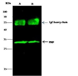 Purine Nucleoside Phosphorylase/PNP Antibody, Novus Biologicals 100 &mu;g;