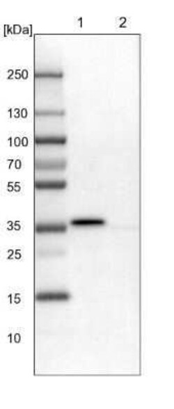 Pyridoxal Kinase/PDXK Antibody, Novus Biologicals:Antibodies:Primary Antibodies