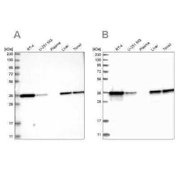 Pyridoxal Kinase/PDXK Antibody, Novus Biologicals:Antibodies:Primary Antibodies