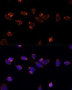 Pyruvate Dehydrogenase E1-alpha subunit Antibody - Azide and BSA Free,