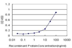 Pyruvate Dehydrogenase E1 beta subunit Antibody (2B2), Novus Biologicals 0.1 mg | Buy Online | Novus Biologicals | Fisher Scientific