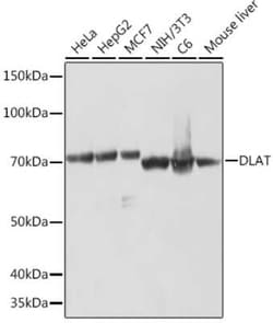 Pyruvate Dehydrogenase E2 Rabbit anti-Human, Mouse, Rat, Clone: 2Z7R10,