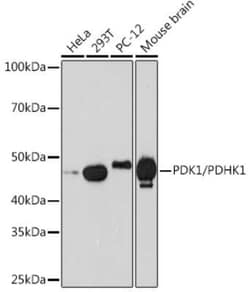 Pyruvate Dehydrogenase Kinase 1/PDK1 Rabbit anti-Human, Mouse, Rat, Clone: