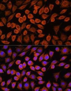 Pyruvate Dehydrogenase Phosphatase/PDP1/PPM2C Antibody - Azide and BSA