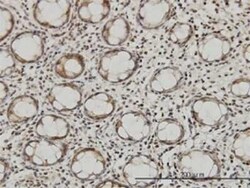 QARS Antibody (5F5), Novus Biologicals 0.1 mg | Buy Online | Novus Biologicals | Fisher Scientific