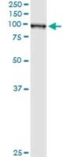 QARS Antibody (5F5), Novus Biologicals 0.1 mg | Buy Online | Novus Biologicals | Fisher Scientific