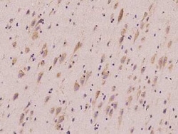 QARS Antibody, Novus Biologicals:Antibodies:Primary Antibodies