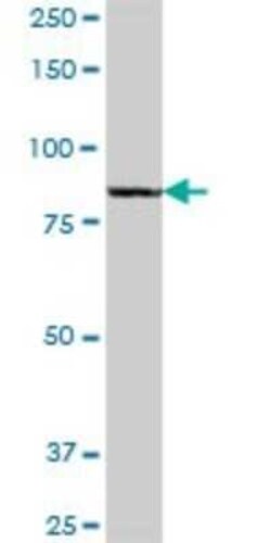 QARS Antibody, Novus Biologicals 0.05 mg | Buy Online | Novus Biologicals | Fisher Scientific