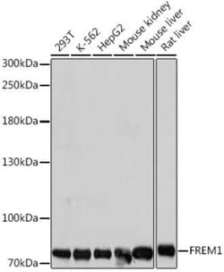 QBRICK/FREM1 Antibody - Azide and BSA Free, Novus Biologicals:Antibodies:Primary