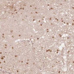 QDPR Antibody, Novus Biologicals:Antibodies:Primary Antibodies