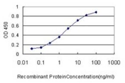 QDPR Antibody (M1), Novus Biologicals 0.1 mg | Buy Online | Novus Biologicals | Fisher Scientific