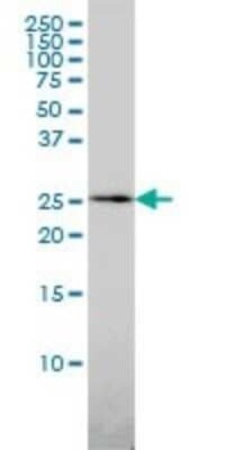 QDPR Antibody (M1), Novus Biologicals 0.1 mg | Buy Online | Novus Biologicals | Fisher Scientific