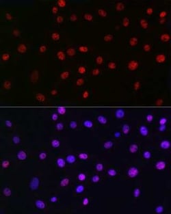 QKI/Quaking Rabbit anti-Human, Mouse, Rat, Clone: 1D1N6, Novus Biologicals 100 &mu;g | Buy Online | Novus Biologicals | Fisher Scientific