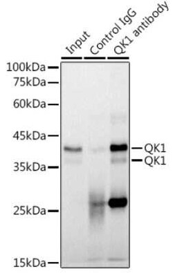 QKI/Quaking Rabbit anti-Human, Mouse, Rat, Clone: 1D1N6, Novus Biologicals 100 &mu;g | Buy Online | Novus Biologicals | Fisher Scientific