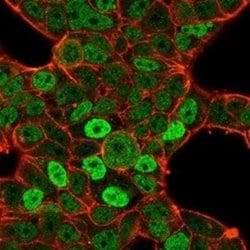 QKI/Quaking Mouse anti-Human, Clone: PCRP-QKI-2F10, Novus Biologicals 100