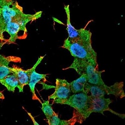 QKI/Quaking Antibody (S147-6) - Pan Specific, Novus Biologicals 0.1 mg;