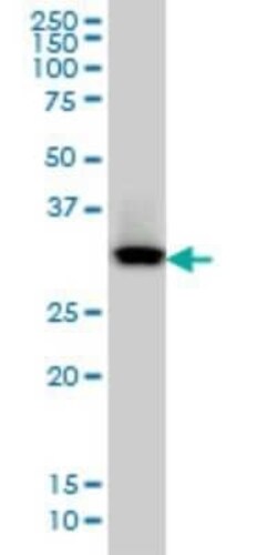 QPRT Antibody (5D11), Novus Biologicals 0.1 mg | Buy Online | Novus Biologicals | Fisher Scientific