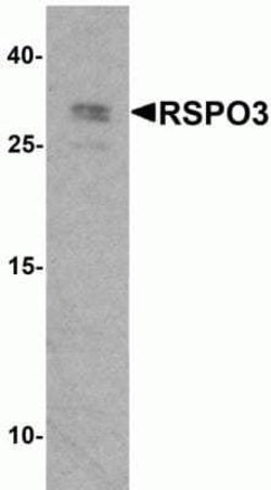 R-Spondin 3 Antibody - BSA Free, Novus Biologicals 0.1 mg | Buy Online | Novus Biologicals | Fisher Scientific