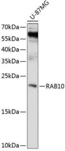 RAB10 Antibody - BSA Free, Novus Biologicals 0.02 mL, Unconjugated:Antibodies,
