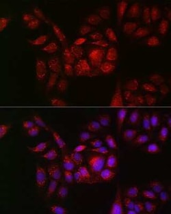 RAB11B Antibody - Azide and BSA Free, Novus Biologicals:Anticuerpos:Anticuerpos