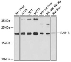 RAB18 Antibody - BSA Free, Novus Biologicals:Antibodies:Primary Antibodies