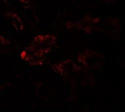 RAB21 Antibody - BSA Free, Novus Biologicals 0.1 mg | Buy Online | Novus Biologicals | Fisher Scientific