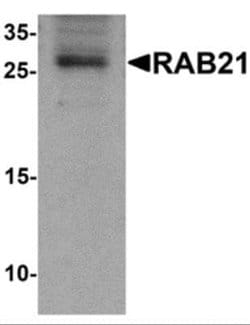 RAB21 Antibody - BSA Free, Novus Biologicals 0.1 mg | Buy Online | Novus Biologicals | Fisher Scientific