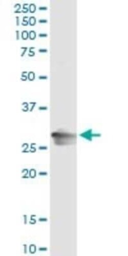 RAB32 Antibody (1C7), Novus Biologicals 0.1 mg | Buy Online | Novus Biologicals | Fisher Scientific
