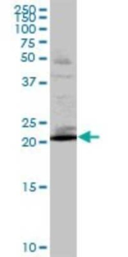 RAB32 Antibody, Novus Biologicals 0.05 mg; Unconjugated:Antibodies, Polyclonal