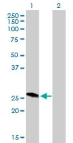 RAB32 Antibody, Novus Biologicals 0.05 mg; Unconjugated:Antibodies, Polyclonal