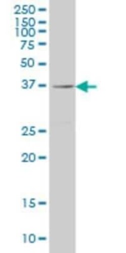 RAB36 Antibody (6A6), Novus Biologicals 50 &mu;g | Buy Online | Novus Biologicals | Fisher Scientific