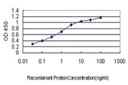 RAB38 Antibody (7F1), Novus Biologicals 0.1 mg | Buy Online | Novus Biologicals | Fisher Scientific